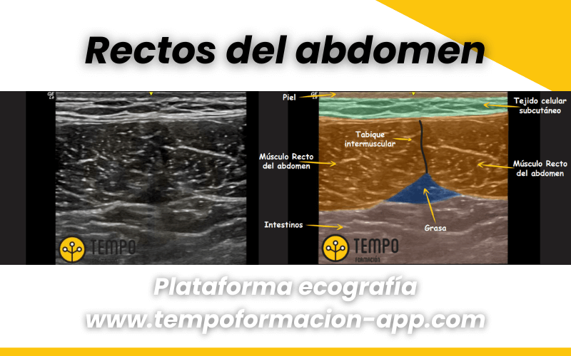 Anatomía Y Ecografía Cadera Tempo Formación